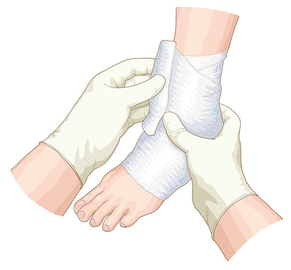 The bandage on the joint.