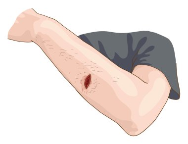 The Wound. clipart