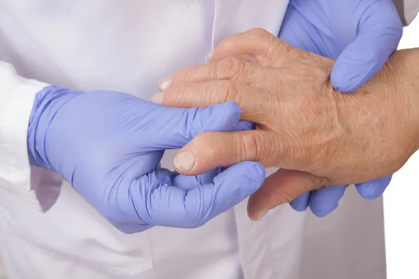 Старшая женщина с ревматоидным артритом обращается к врачу — стоковое фото