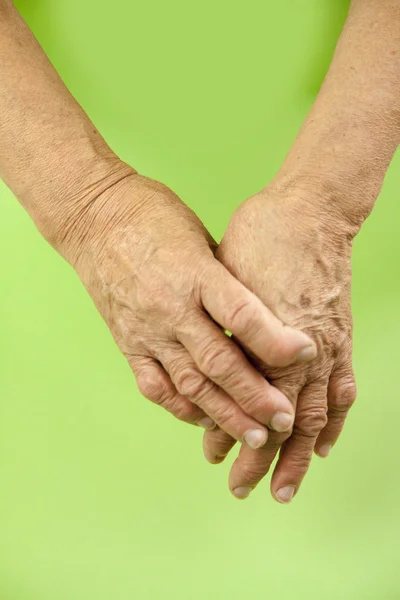 Artrite reumatoide mãos — Fotografia de Stock