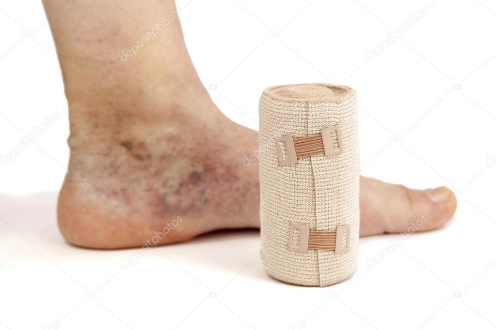 bandage din varicoseza)