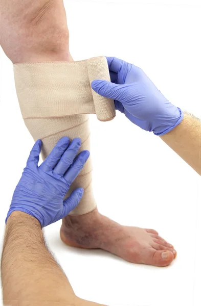 Varicose veins and bandage — Stock Photo, Image