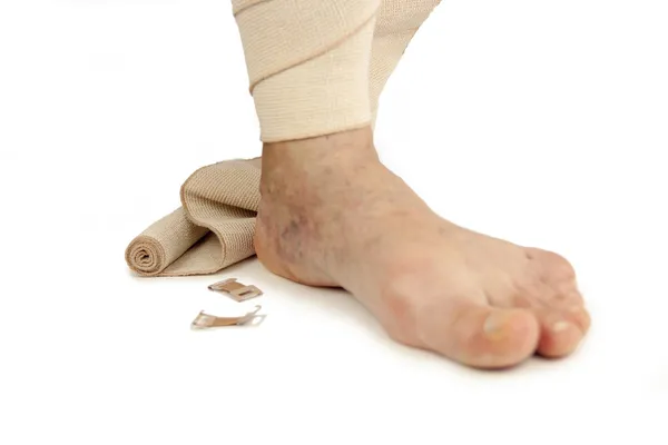 Varicose veins and bandage — Stock Photo, Image