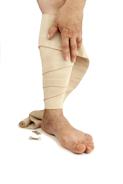 Varicose veins and bandage — Stock Photo, Image