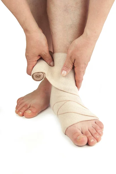 Varicose veins and bandage — Stock Photo, Image