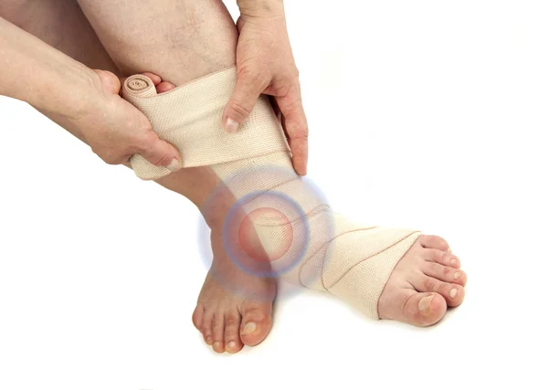 Varicose veins and bandage — Stock Photo, Image