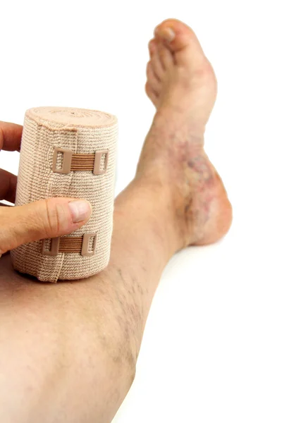 Åderbråck och bandage — Stockfoto