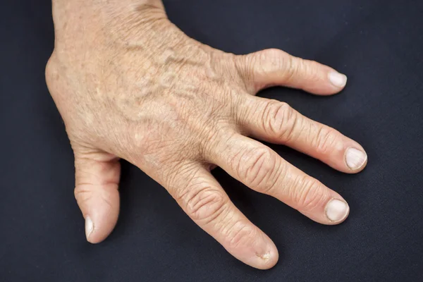 Палец без гвоздя — стоковое фото