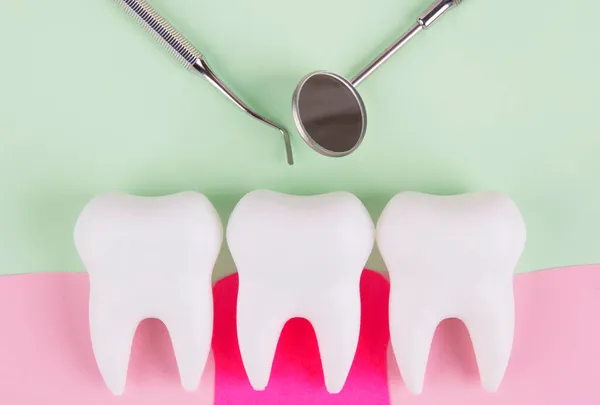 Dente Con Uno Specchio Dentale Uno Strumento Dentista Gengive Infiammate — Foto Stock