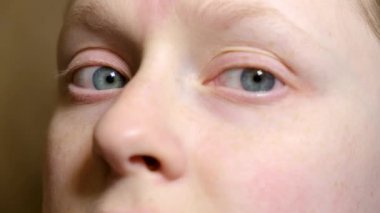 Yatay nistagmus 'u olan yakın plan kadın, göz yuvarlarının kontrolsüz ritmik hareketleri olan kadın..