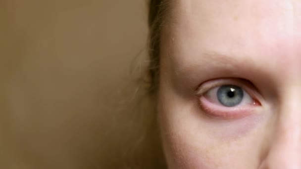 Zblízka žena s horizontální nystagmus, žena s nekontrolovaným rytmickým pohybem očních bulv. — Stock video