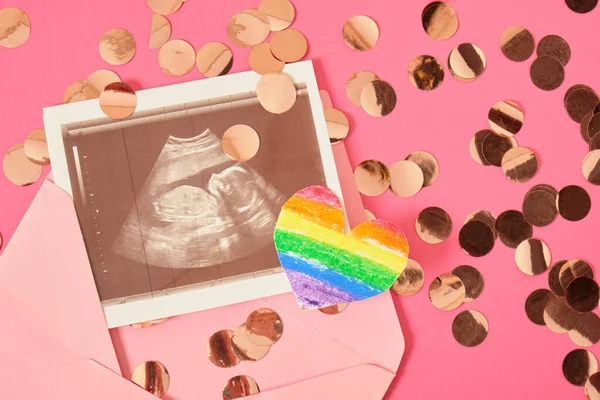Herz Mit Regenbogen Und Ultraschall Der Schwangerschaft Rosa Umschlag Schwangerschaft — Stockfoto