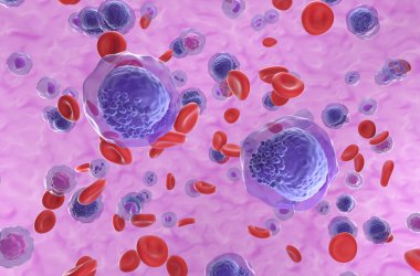 Kan akışında akut miyeloid lösemi (AML) hücreleri - izometrik görünüm 3d illüstrasyon