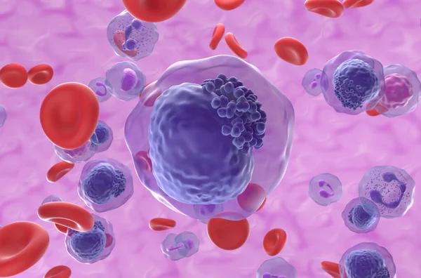 Acute Myeloid Leukemia Aml Cells Blood Flow Closeup View Illustration — Stock Photo, Image