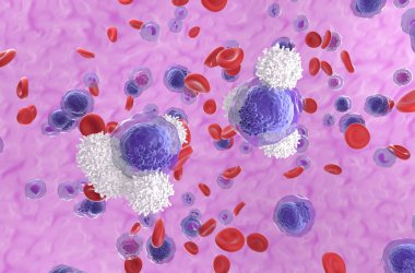 T-hücreleri kan akışındaki akut miyeloid lösemi (AML) hücrelerine saldırır - izometrik görünüm 3d