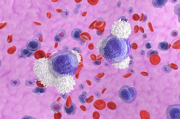 T-hücreleri kan akışındaki akut miyeloid lösemi (AML) hücrelerine saldırır - izometrik görünüm 3d