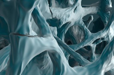 Osteoporozdaki kırık kemikler - izometrik sol görünüm 3d illüstrasyon 