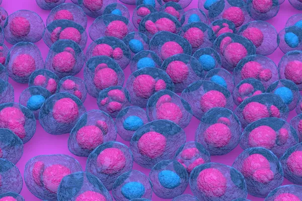 Myeloma Multiplex Leukemia Cancer Color Render Illustration Isometric View — Stock Photo, Image