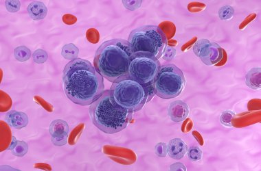 Akut miyeloid lösemi (AML) hücreleri kan akışında kümelenir - izometrik görünüm 3d gösterimi