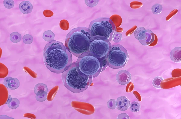 Akut miyeloid lösemi (AML) hücreleri kan akışında kümelenir - izometrik görünüm 3d gösterimi