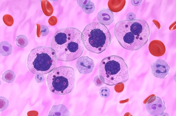 Células Mieloma Múltiple Agrupadas Flujo Sanguíneo Vista Isométrica Ilustración — Foto de Stock