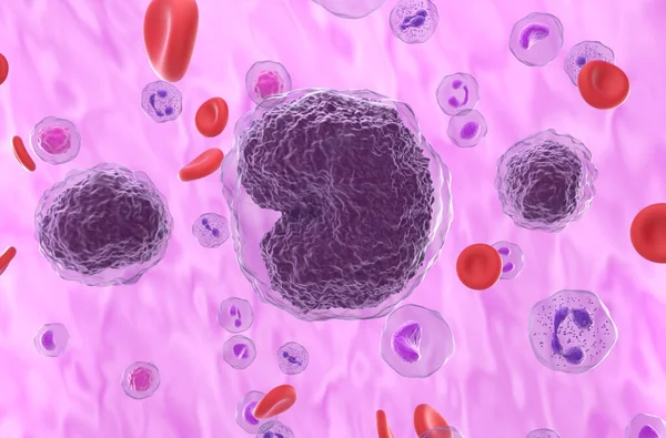 Non Hodgkin Lymphoma Nhl Cells Blood Flow Closeup View Illustration — стоковое фото