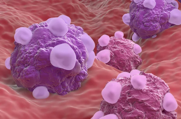 Ovarian cancer cell variations - closeup view 3d illustration