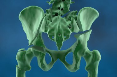 Osteoporozda kırık leğen kemiği, uyluk kemiği ve omurga - izometrik görüntü 3d