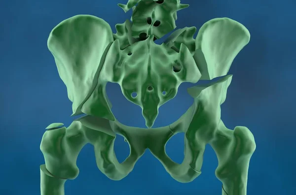 Κάταγμα Πυέλου Μηριαίου Οστού Και Της Σπονδυλικής Στήλης Στην Οστεοπόρωση — Φωτογραφία Αρχείου
