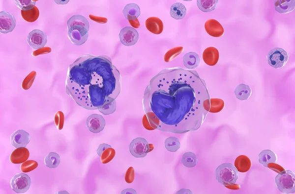 Células Leucemia Mielógena Crónica Lmc Flujo Sanguíneo Vista Cerca Ilustración — Foto de Stock