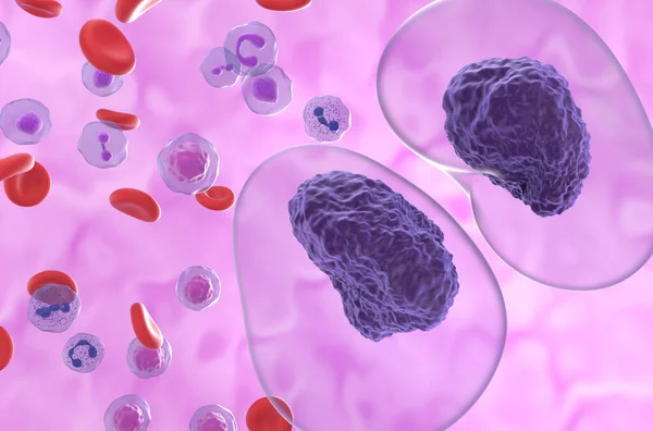 Prolymfocytární Leukémie Pll Nádorové Buňky Super Detailní Pohled Ilustrace — Stock fotografie
