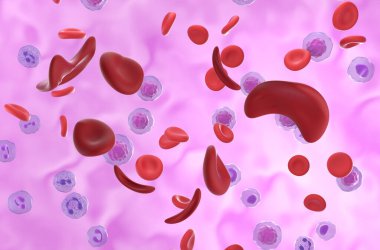 Orak hücre anemi (SCD) hücreleri kan akışında - izometrik görünüm 3d illüstrasyon