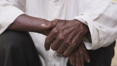 Asyalı adam gülüyor diş problemleri ile