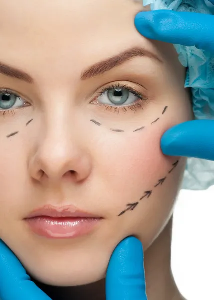 Kvinnliga ansikte innan plastikkirurgi operation — Stockfoto