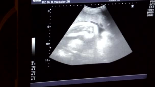 Ultrazvuk miminko