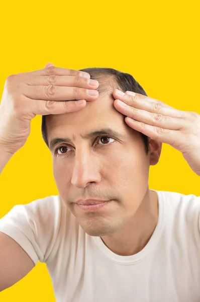 Tiro Hombre Controla Pérdida Cabello Con Fondo Amarillo — Foto de Stock