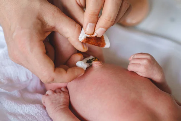 Manos Del Hombre Desconocido Padre Que Cuida Cordón Umbilical Con — Foto de Stock