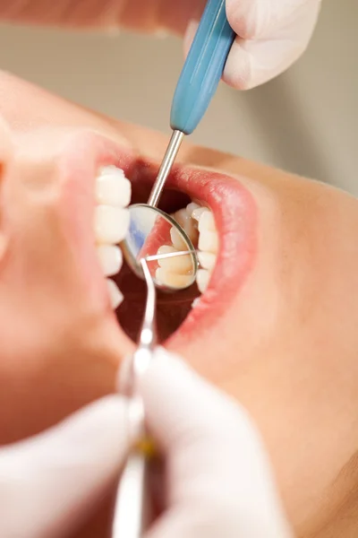 La estomatología es divertida: revisar los dientes en busca de placa y caries —  Fotos de Stock