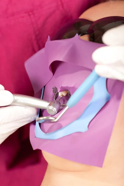 Stomatology is fun: drilling one isolated tooth — Stock Photo, Image