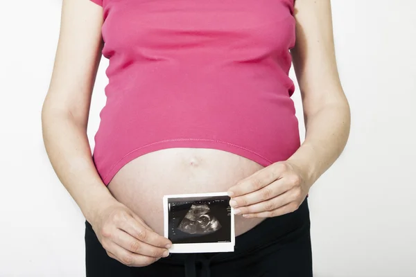 Pregnant woman holding ultrasound baby scan — Stock Photo, Image