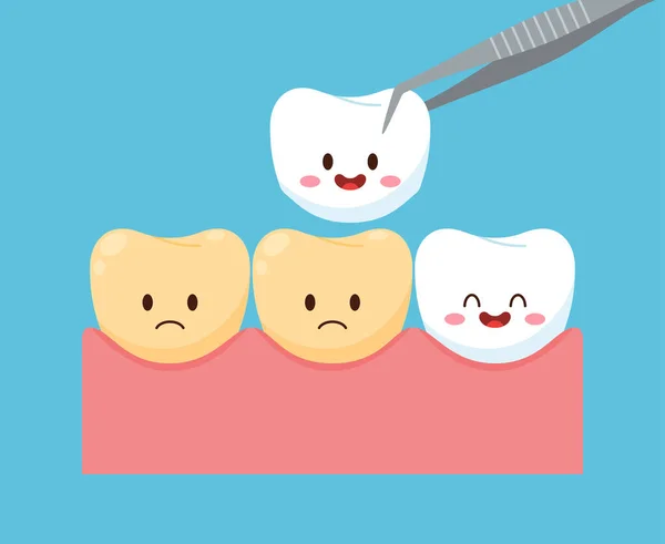 Banner Con Pinzas Dentales Reemplazando Dientes Poco Saludables Con Dientes — Archivo Imágenes Vectoriales