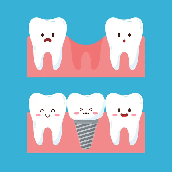 Implante Dentário Antes Depois Caráter Dentes Bonitos Gengiva Ilustração Vetorial —  Vetores de Stock