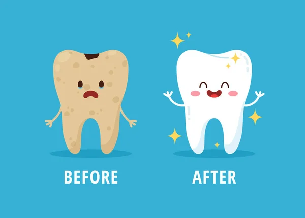 Antes Después Limpieza Dental Blanqueamiento Tratamiento Ilustración Vectorial Plana Sobre — Archivo Imágenes Vectoriales