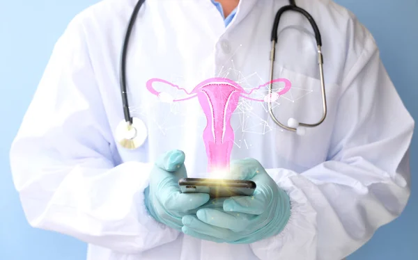 Doctor Holding Phone Model Reproductive System — Stok fotoğraf