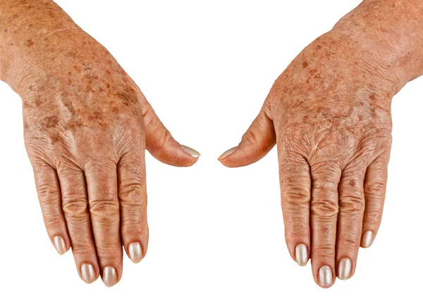 Mãos de uma velha mulher close-up — Fotografia de Stock
