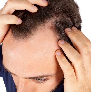 Man controls hair loss clipart