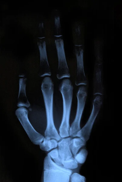 X-Ray hand — Stockfoto