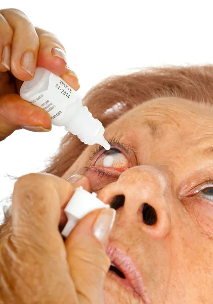 Mujer mayor aplicando gotas para los ojos — Foto de Stock