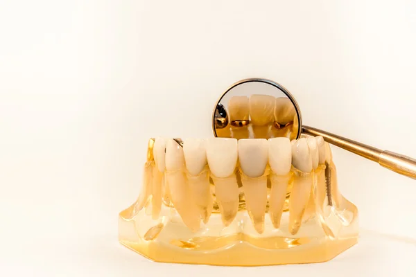 Anterior porcelain crown — Stock Photo, Image