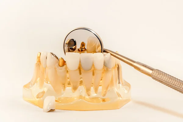 Gold core for anterior crown on model on white background — Stock Photo, Image